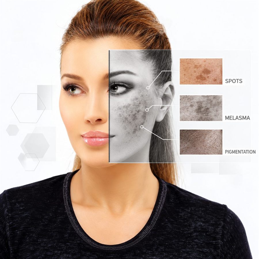 Skin retouching and pigmentation comparison design